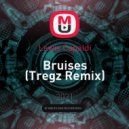 Lewis Capaldi - Bruises (Tregz Remix)