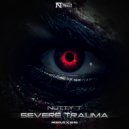 Nutty T - Severe Trauma