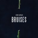 Lewis Capaldi - Bruises (Fabrix Bootleg) (Original Mix)