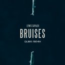 Lewis Capaldi - Bruises