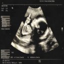 White Baby - Heart Attack